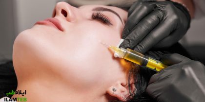 بهترین دکتر تزریق پی آر پی prp در ایلام 26